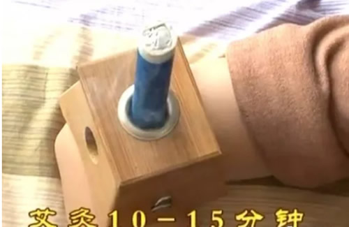 [艾灸视频]艾灸一穴，防治荨麻疹