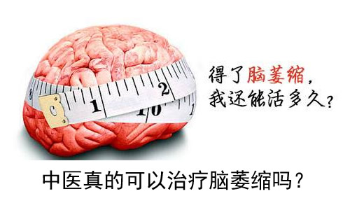 中医真的可以治疗脑萎缩吗？
