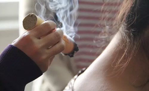 甲状腺结节可以艾灸吗