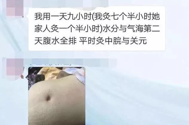 医院判死刑,艾灸捡回一条命