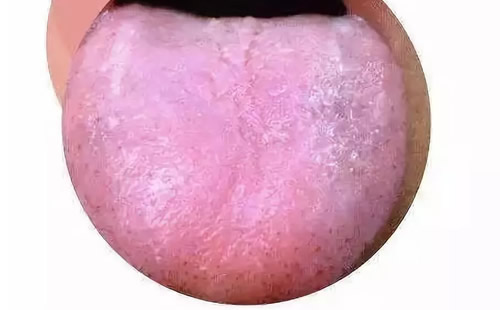 腰疼怎么办腰疼艾灸哪里