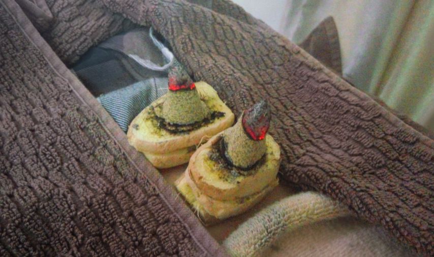 艾灸神阙穴
