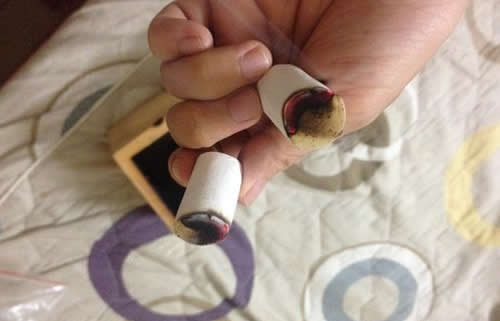 用灸盒自己在家艾灸图片