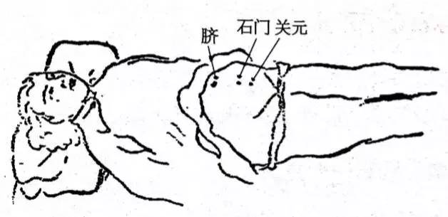 妇科炎症自己怎么调理