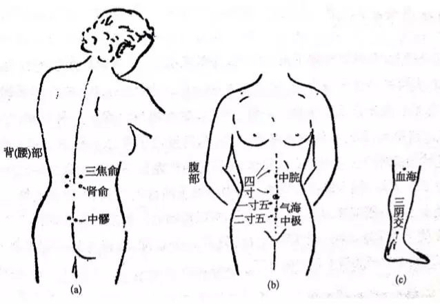 妇科炎症自己怎么调理
