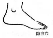 妇科炎症自己怎么调理