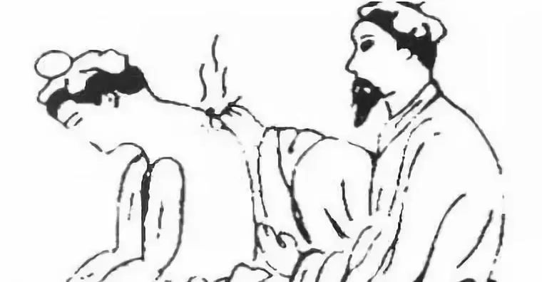 舌头有齿痕是怎么回事