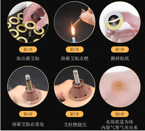 <b>艾灸贴艾艾贴多少钱一盒_艾艾灸贴</b>