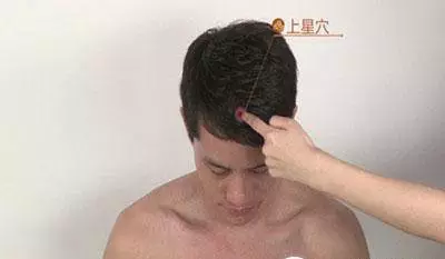 小孩鼻炎艾灸哪个部位