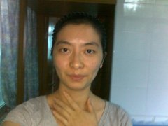 脸色黄面色发黄咋办艾灸调理