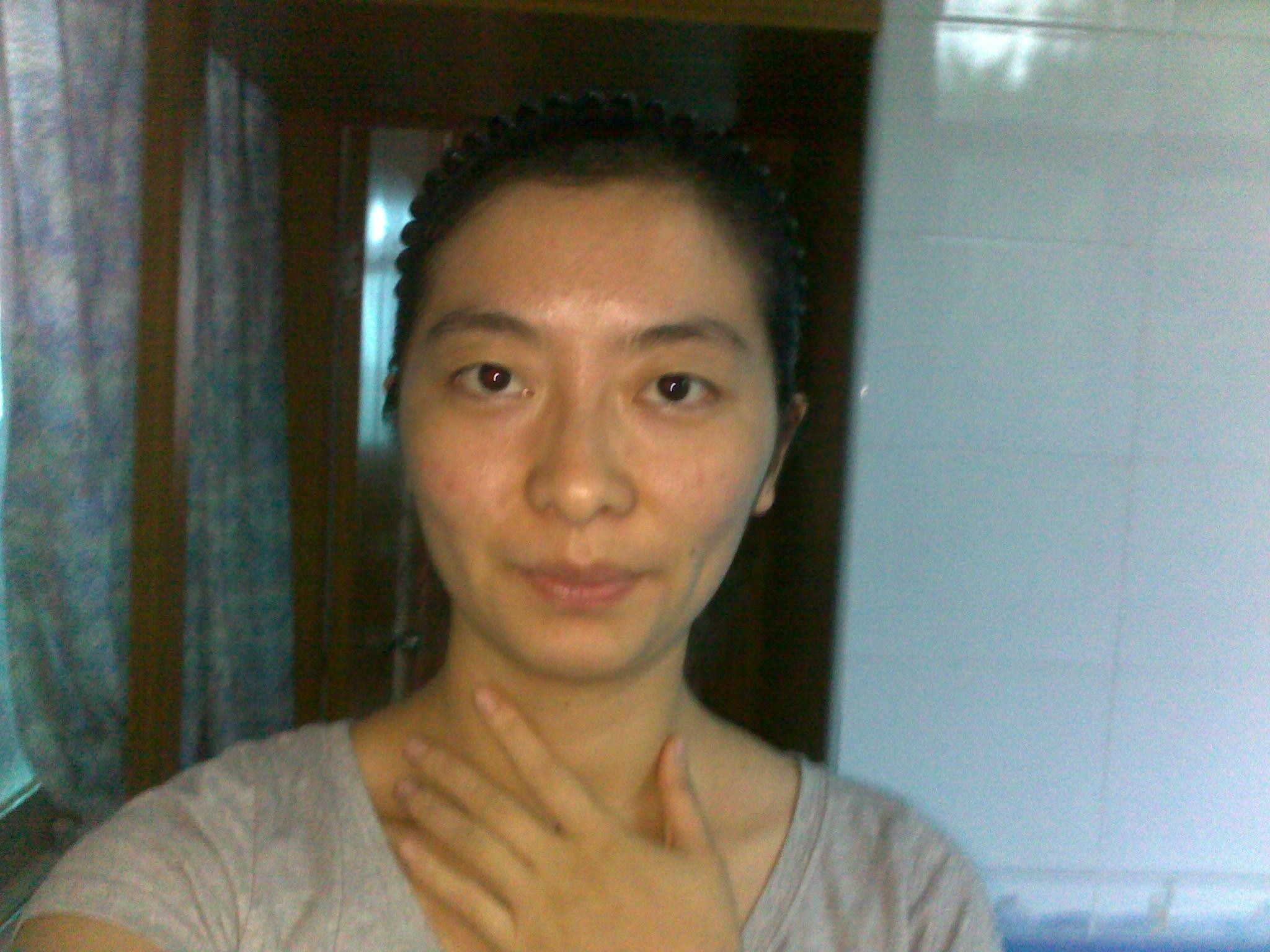 面色发黄是什么原因  