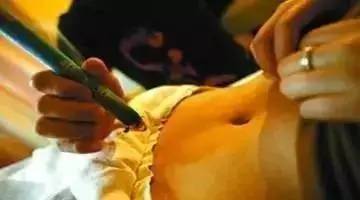 艾灸减肥灸哪里