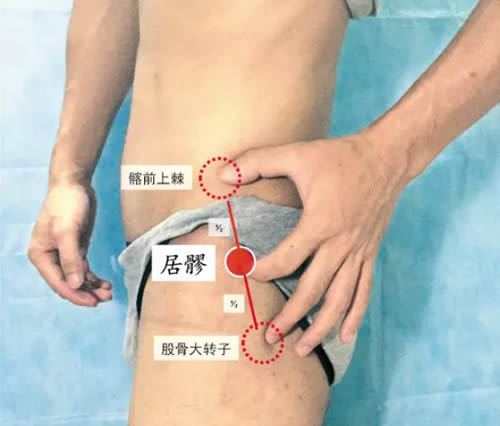 艾灸减肥方法图解