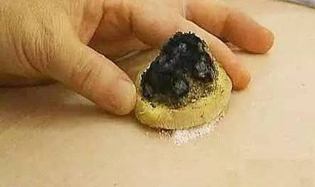 神阙隔姜灸