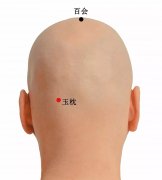 玉枕穴:主治头项痛目痛鼻塞鼻炎