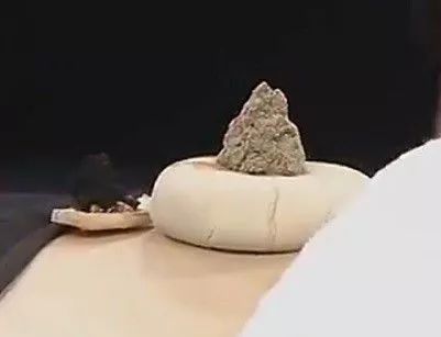药物敷灸:中药天南星灸