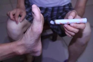 艾灸方法