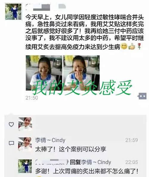 艾灸治疗鼻炎的方法
