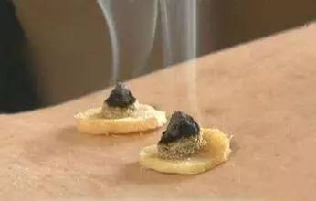艾灸罐有作用吗?
