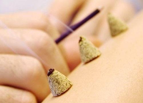 扭挫伤灸法