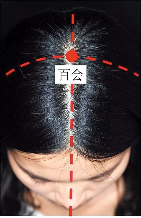 脑血栓艾灸