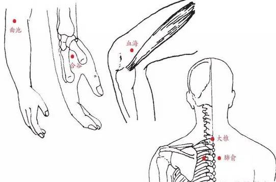 儿童艾灸实例艾度有缘人