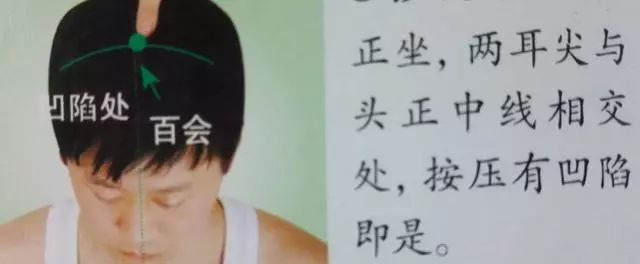 百会
