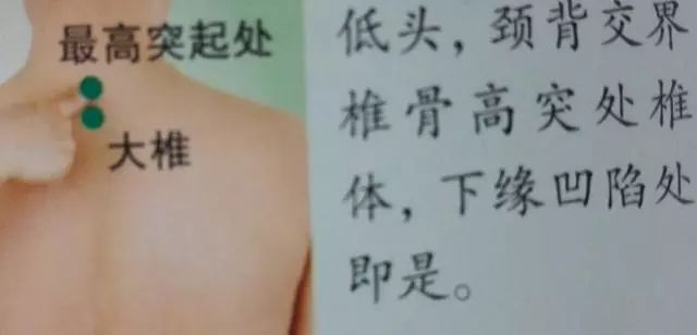 大椎
