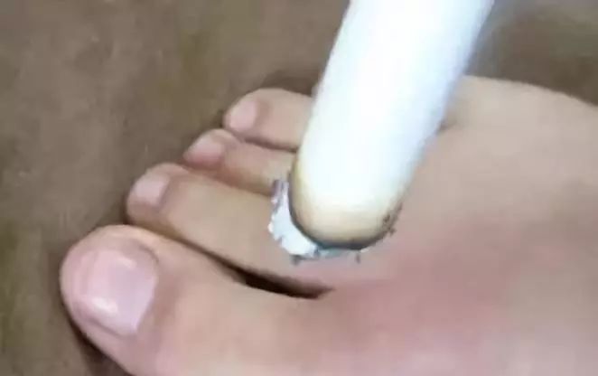 艾灸效果不好,加上太冲一起灸！