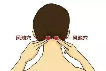 偏头痛艾灸治疗方法