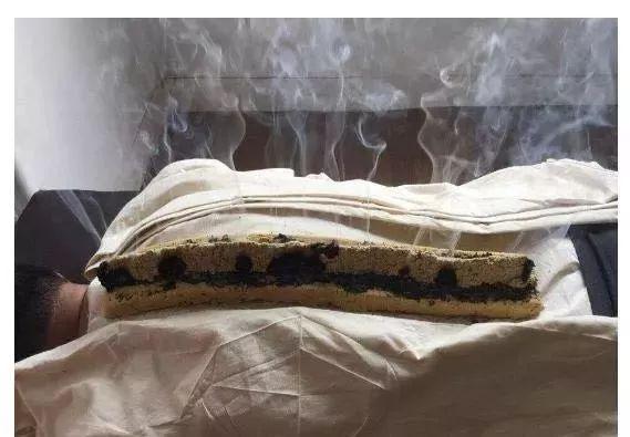 艾灸禁忌:滥用艾灸会惹祸!