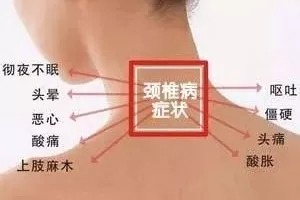 艾灸