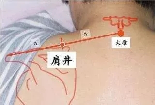 艾灸的好处与功效