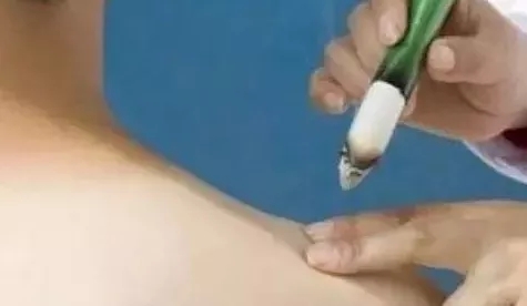 艾灸的好处与功效