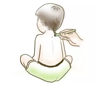 艾灸养生保健