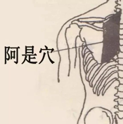 阿是穴