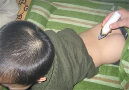 春天儿童可以艾灸吗