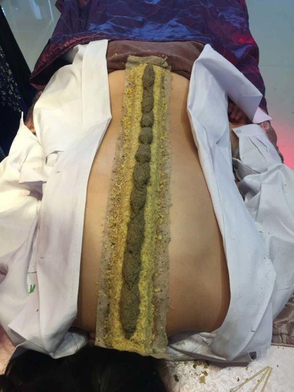艾灸的作用和禁忌