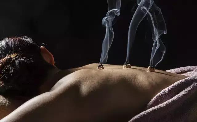 艾灸治疗子宫肌瘤