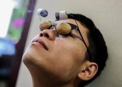 艾灸的功效