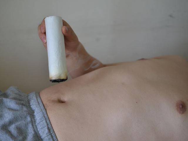 艾灸薰肚脐