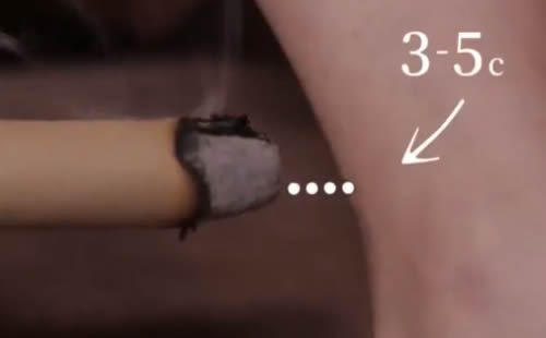 艾灸的好处与功效