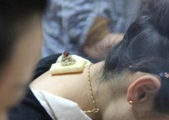 几点做艾灸效果最好?晚上能不能艾灸?