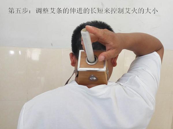 艾灸的好处与功效