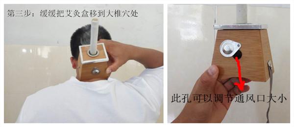 艾灸的作用和禁忌