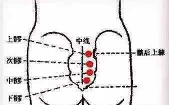 八髎 