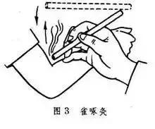 雀啄灸