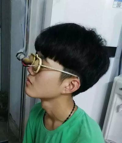 隔核桃眼镜灸