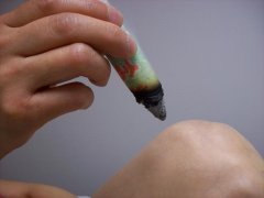夏季什么问题适合艾灸?夏季艾灸适合什么方法
