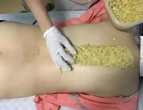 艾灸的作用和禁忌